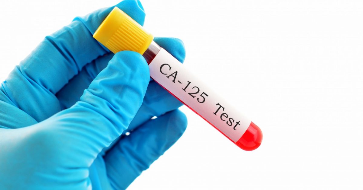 how to get tested for covid antibodies in canada
