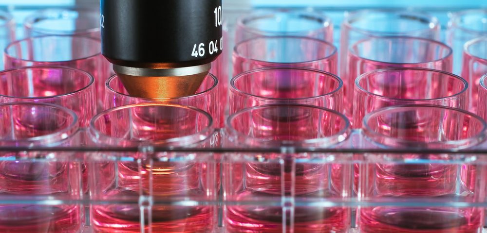 Researchers Identify Anti-Tumor Effects of Apigenin in Malignant Mesothelioma