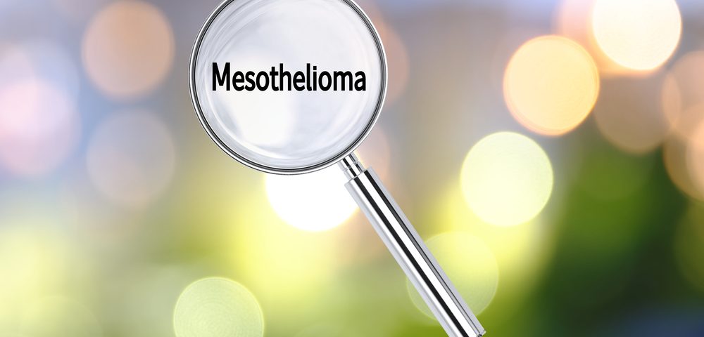 Potential Biomarker of Pleural  Mesothelioma Fails to Distinguish Disease from Lung Cancers in Study