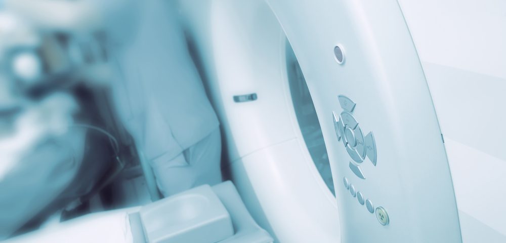 Postoperative Radiotherapy Benefits Limited for Sarcomatoid MPM Patients, Study Finds