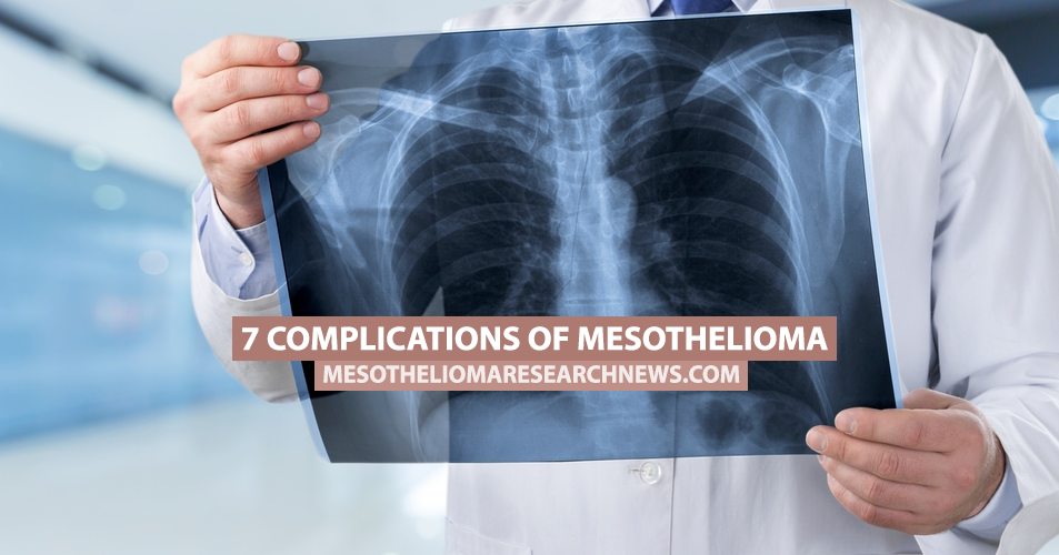 how long does it take to develop mesothelioma